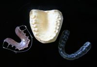 Aparate Dentare Metalice